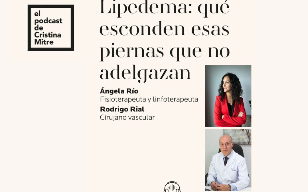 Lipedema: ¿ Qué esconden esas piernas que no adelgazan?